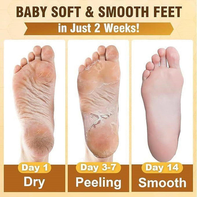 Foot peeling mask for dead skin remover